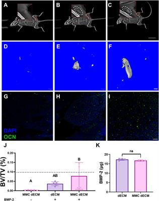 Macromolecular crowding and decellularization method increase the growth factor binding potential of cell-secreted extracellular matrices